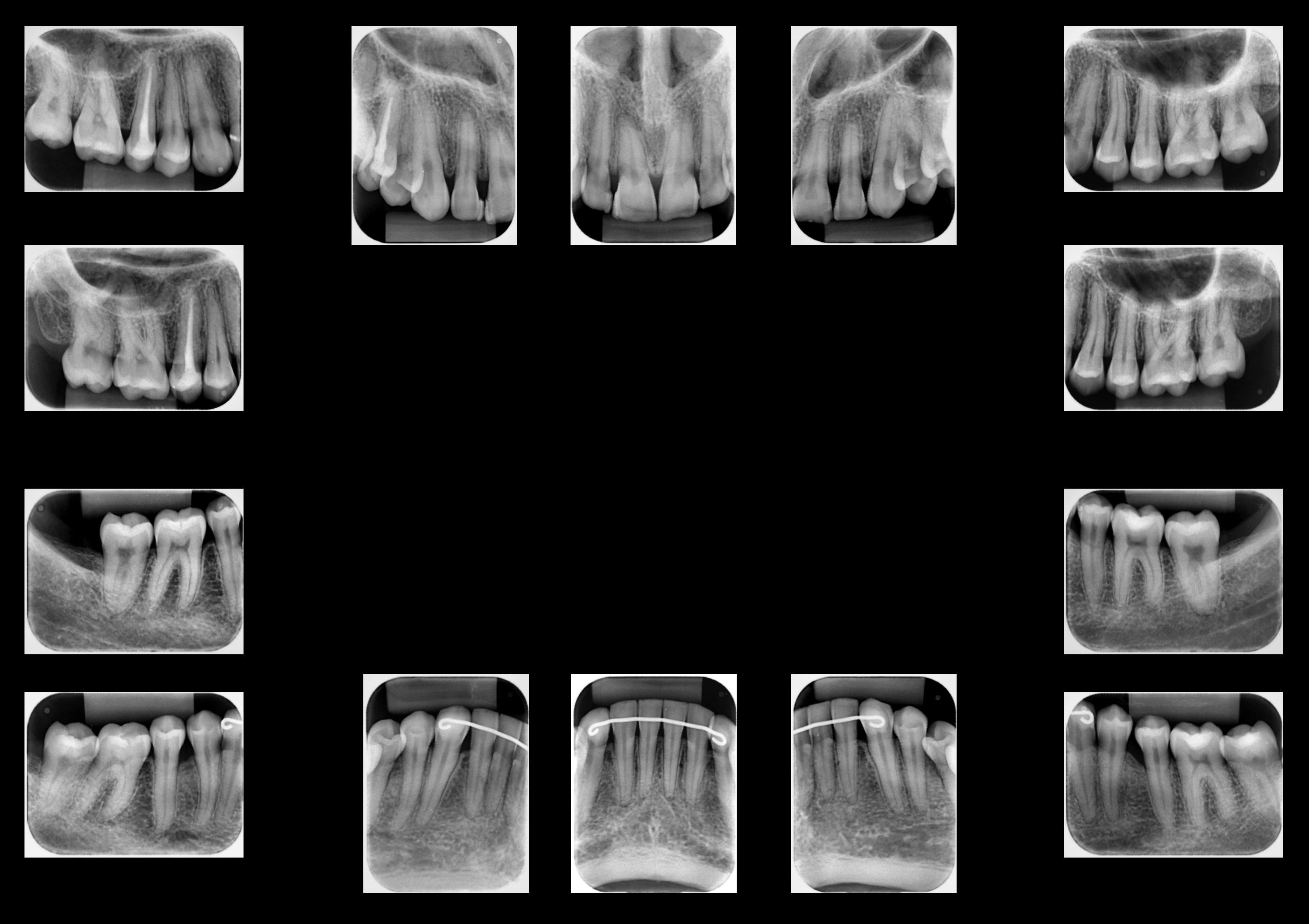 Levantamento periapical